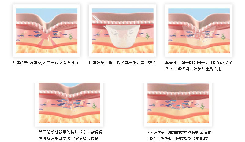 舒顏萃原理