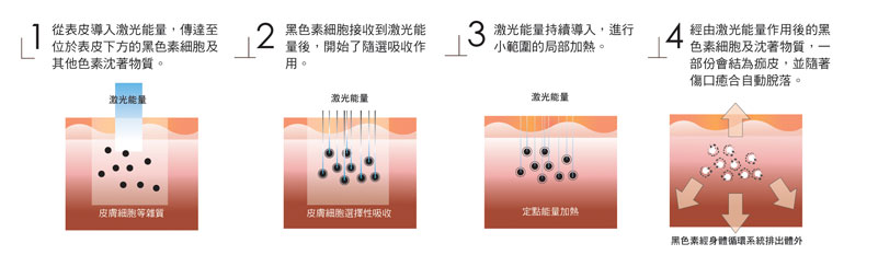 八倍淨膚三種探頭治療