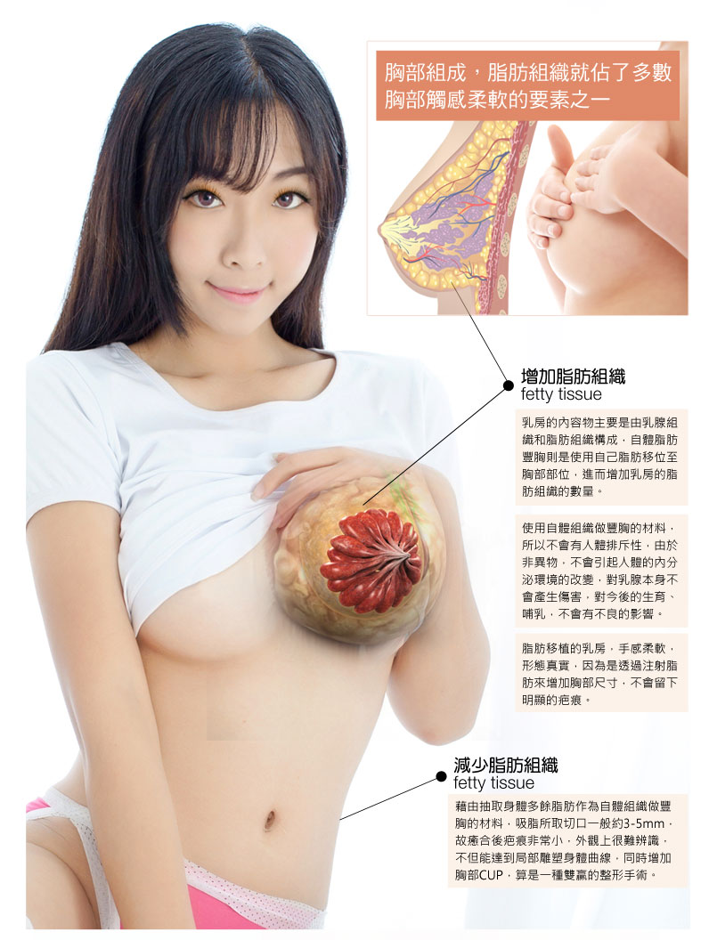 自體脂肪隆乳豐胸部位