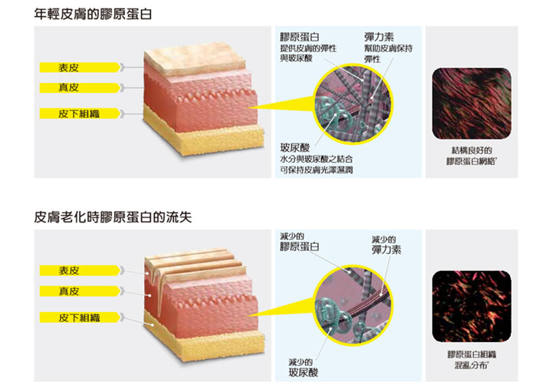 臉部膠原蛋白流失