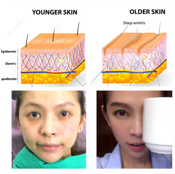 老化膠原蛋白流失圖片