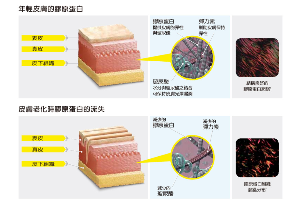 老化肌膚紋理_玻尿酸