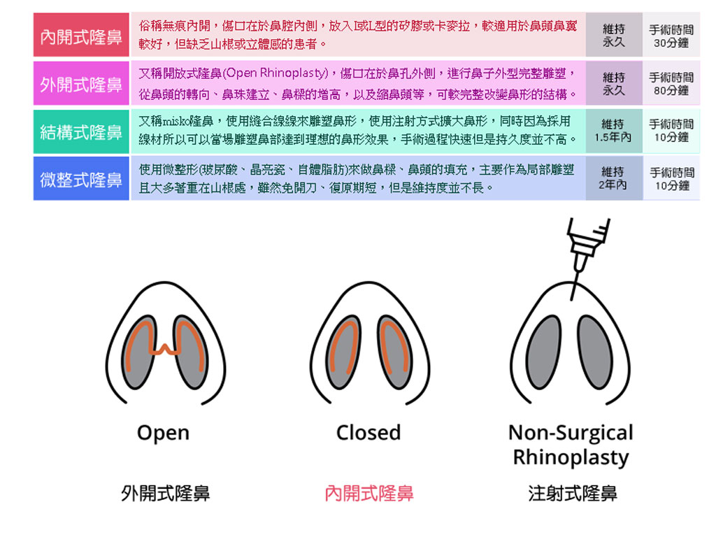 鼻形雕塑介紹_家安