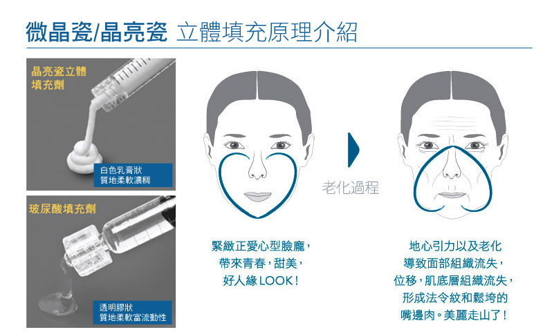 微整形_捕獲野生版金泰希_恆麗美型__微晶瓷隆鼻_介紹