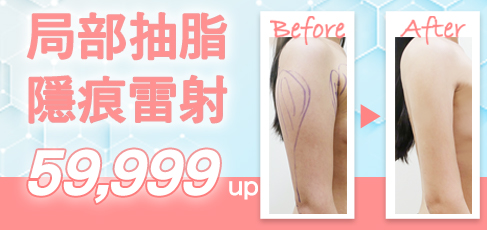 抽脂1部位28999，狠甩皮下脂肪一起抽出來