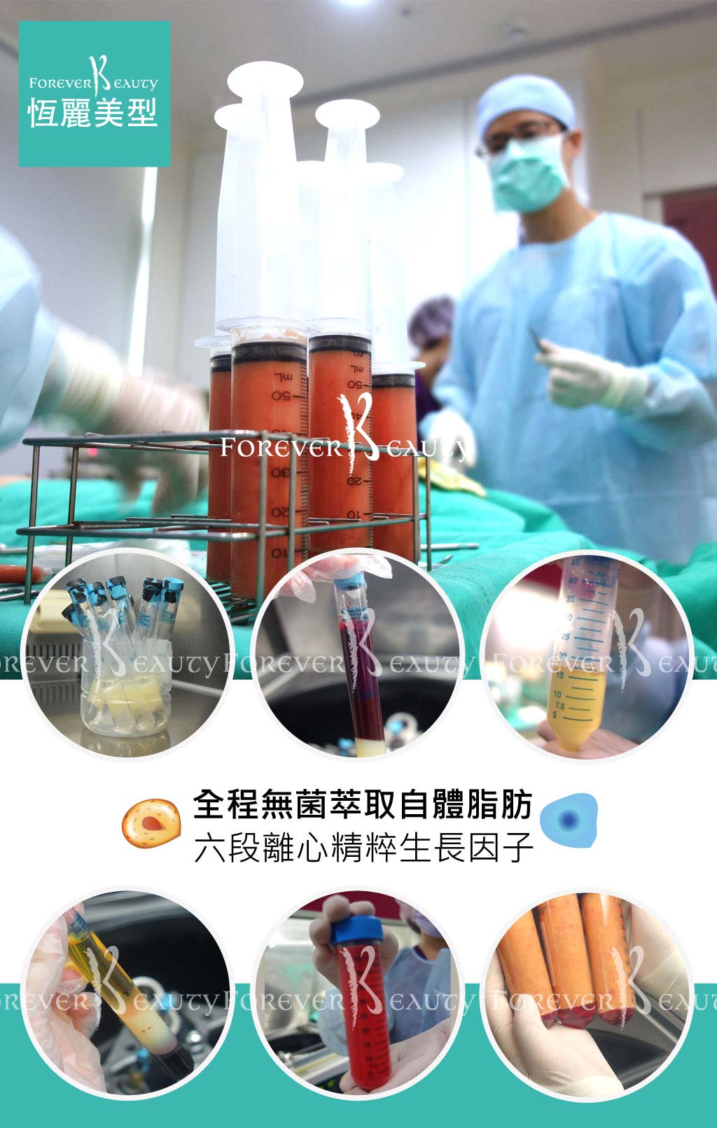 恆麗美型_蔡家碩_自體脂肪隆乳豐胸補臉_生長因子_脂肪幹細胞_純化脂肪_六道程序