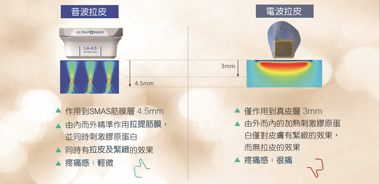 拉皮儀器比較_電波音波比較