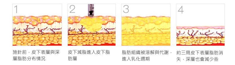 carnitine_消脂針_溶脂針_瘦臉_作用