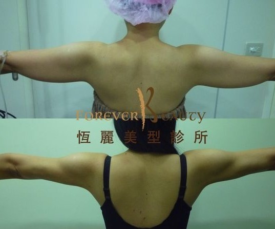 forbeauty_1440585715_870