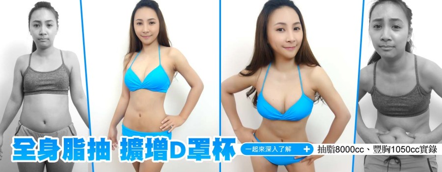 肥腫妹抽脂豐胸~桃花人緣一次滿足