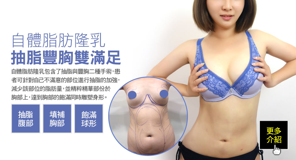 自體脂肪隆乳抽脂豐胸雙滿足_自體脂肪隆乳案例_自體脂肪隆乳推薦_恆麗美型隆乳_蔡家碩隆乳_自體脂肪隆乳失敗_自體脂肪隆乳硬塊