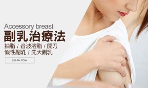 副乳手術推薦 抽脂/切除/電波拉皮