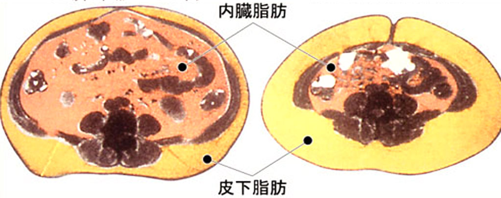 內臟型脂肪_減肥推薦_運動復胖_皮下脂肪消除_抽脂推薦_快速減肥_恆麗美型_蔡家碩