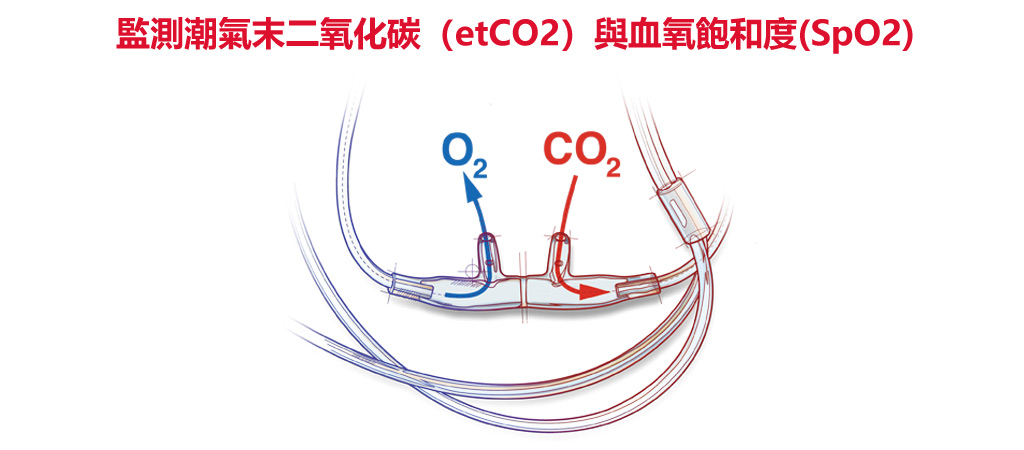 SpO2血氧量_抽脂麻醉_隆乳麻醉_麻醉生命監測_潮氣末二氧化碳_etCO2檢測_恆麗美型_整形麻醉安全_微整形舒眠麻醉_10