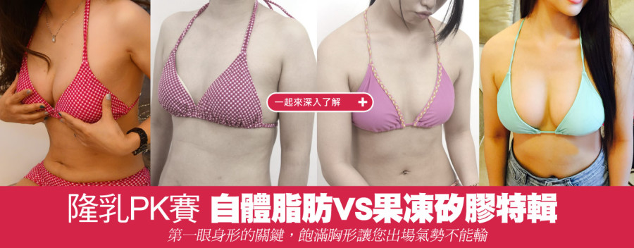 自體脂肪隆乳特輯