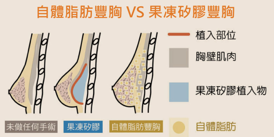 【豐胸食物無效】 青木瓜豐胸根本沒效 豐胸食物文章不會告訴您的關鍵(2-4)