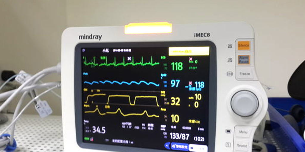 抽脂死亡_抽脂脂肪栓塞_抽脂後遺症_抽脂休克_抽脂麻醉_抽脂手術麻醉_01