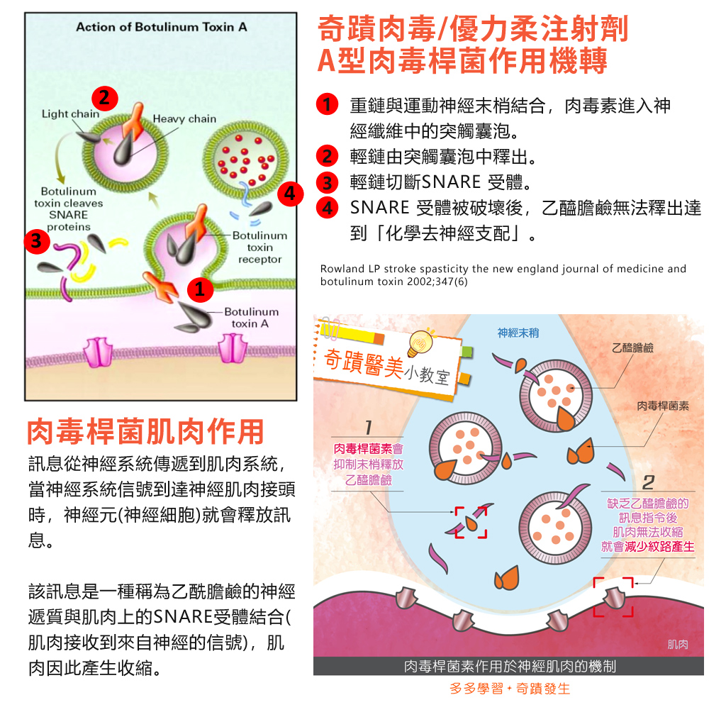 Neuronox優力柔肉毒_奇蹟肉毒_04