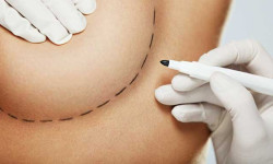 隆乳後遺症有哪些？注意這7大隆乳手術後遺症！