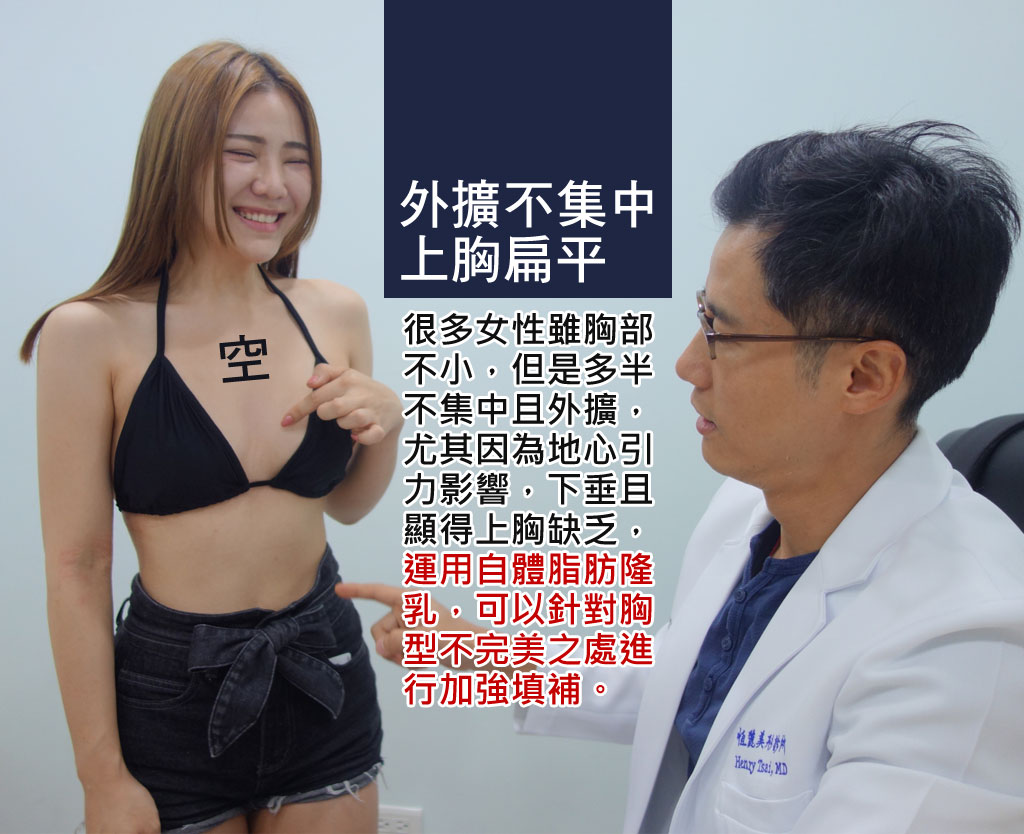 隆乳效果_自體脂肪隆乳_自體脂肪豐胸_隆乳術後_隆乳推薦_自體脂肪豐胸_自體隆乳_網紅隆乳_IG隆乳_泥泥學姊_症狀