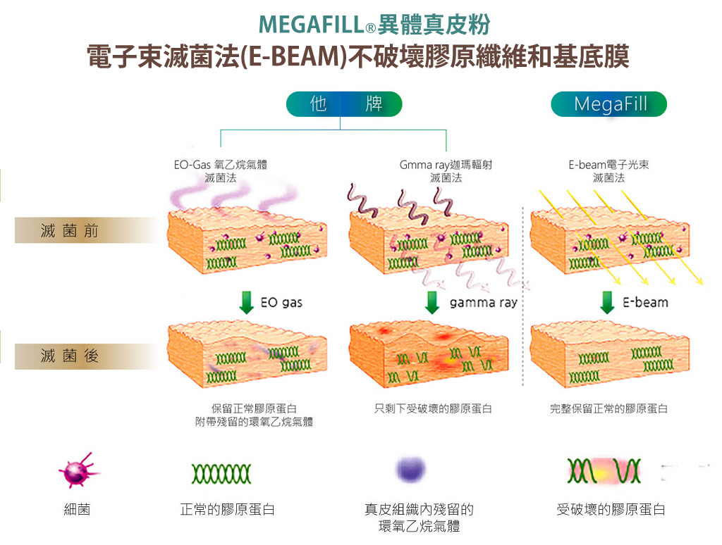 MegaFill_異體真皮_異體真皮粉_微整形_美嘉膚_05