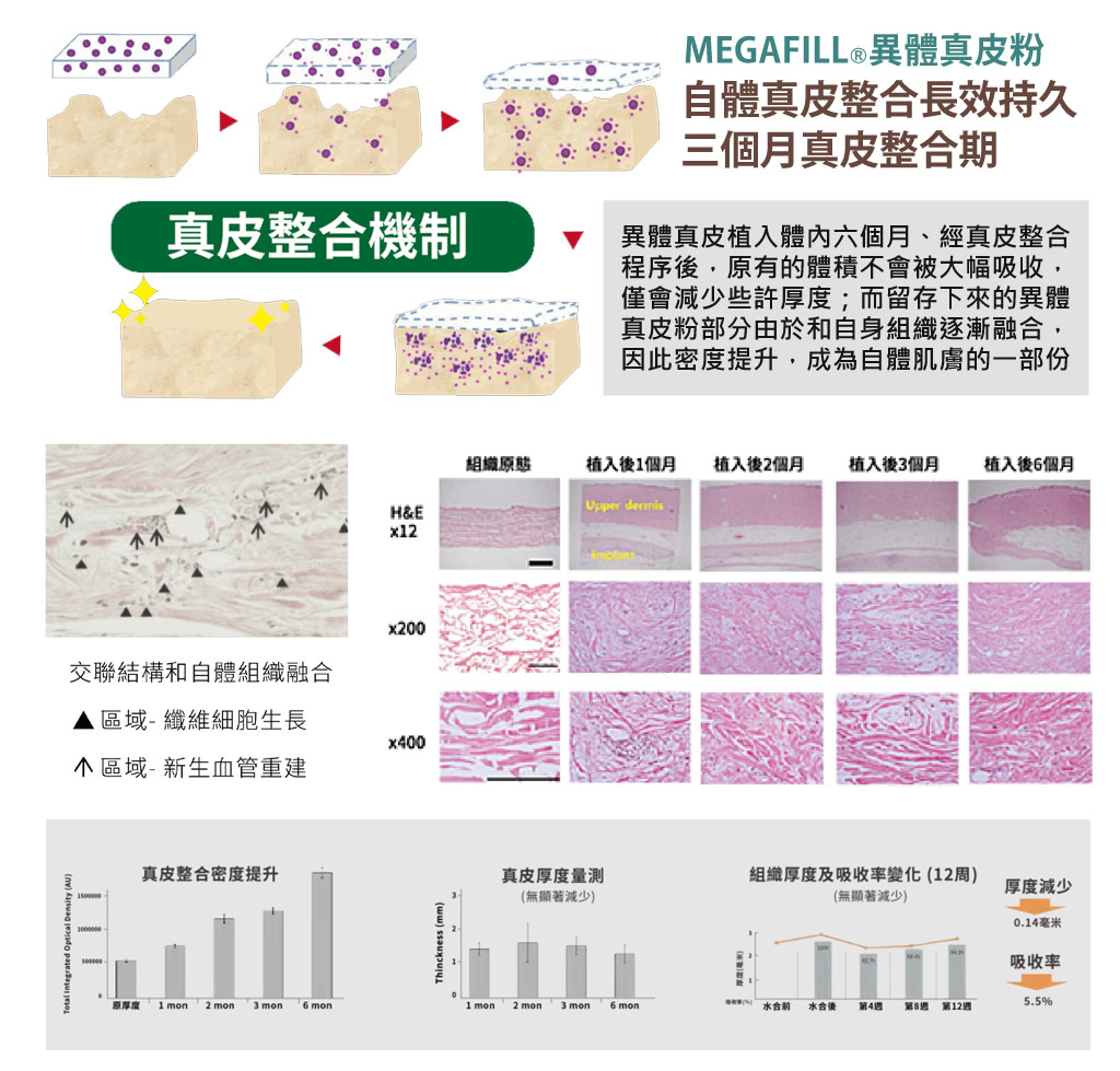 MegaFill_異體真皮_異體真皮粉_微整形_美嘉膚_07