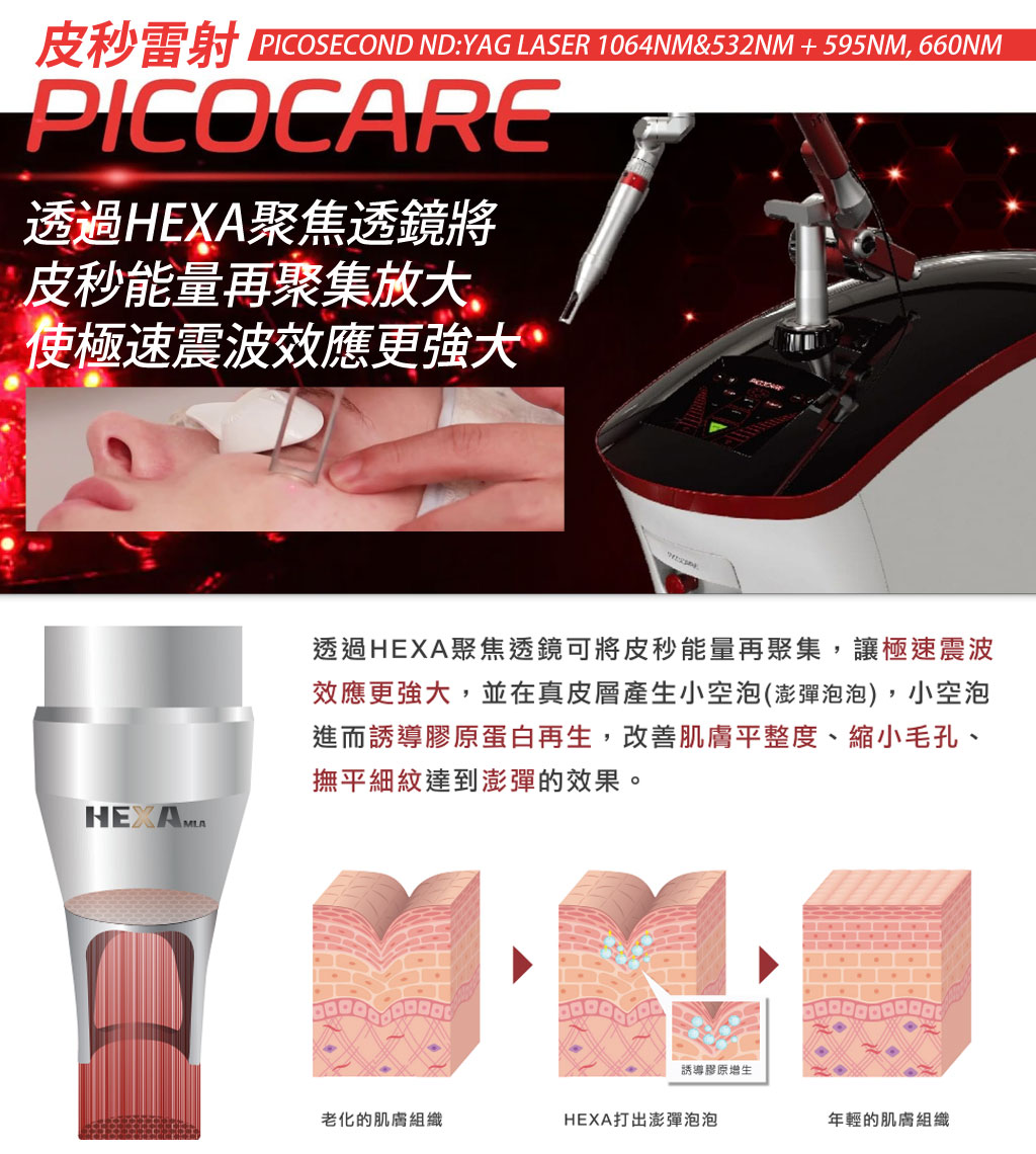 picocare皮秒雷射_蜂巢雷射_皮秒痘疤_皮秒疤痕淡化_斑點治療_皮秒斑點_04