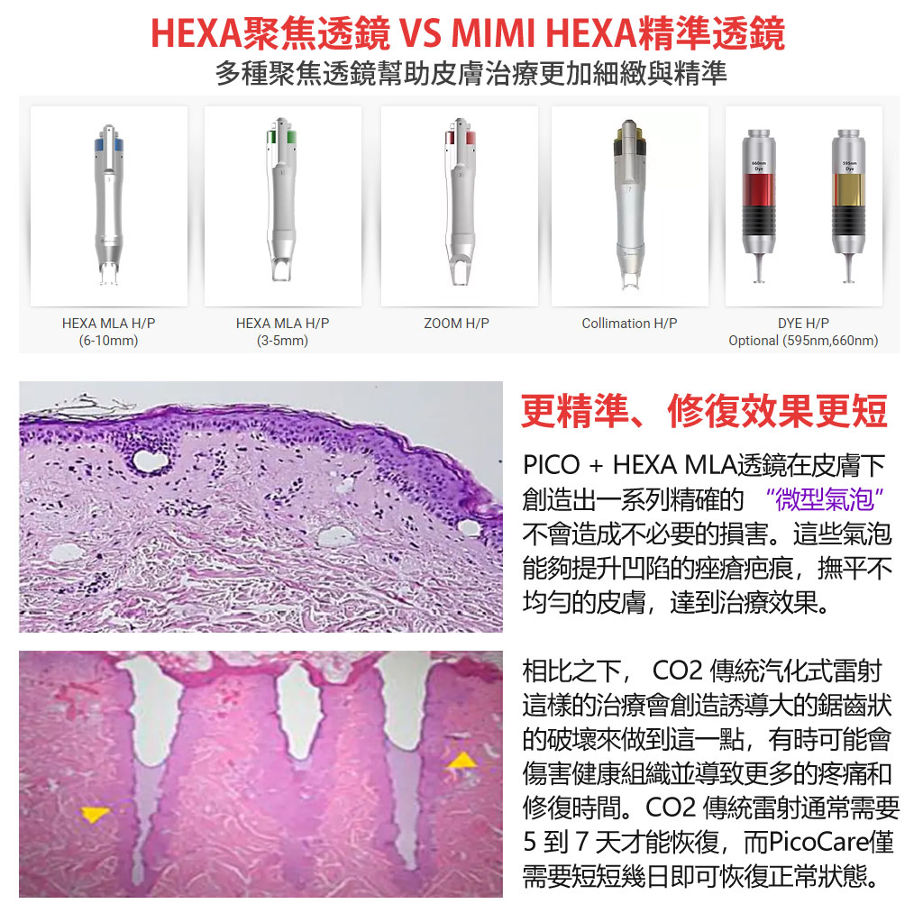 picocare皮秒雷射_蜂巢雷射_皮秒痘疤_皮秒疤痕淡化_斑點治療_皮秒斑點_05