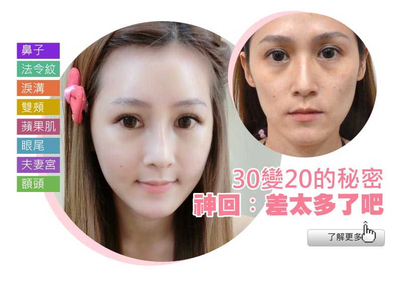 forbeauty_1458194846_808