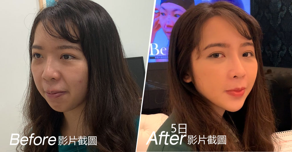 forbeauty_1606290985_552