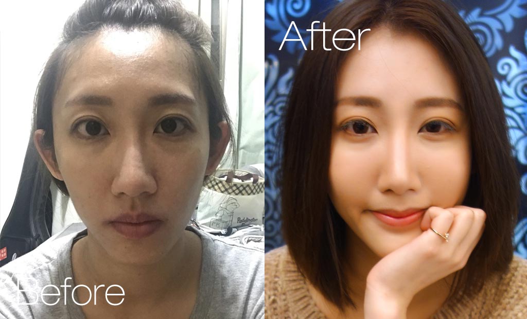 forbeauty_1518078561_571