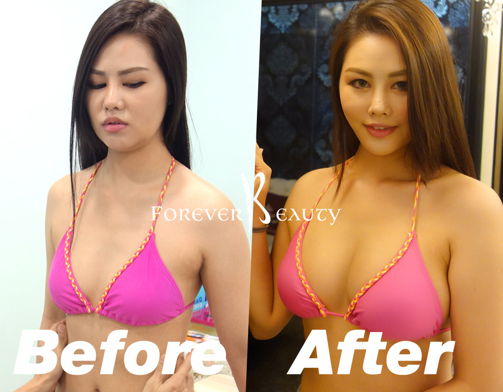 forbeauty_1581062531_858