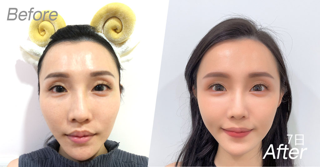 forbeauty_1606290985_552