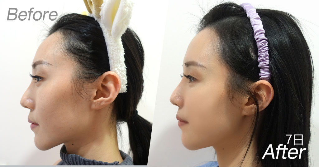 forbeauty_1606290985_552