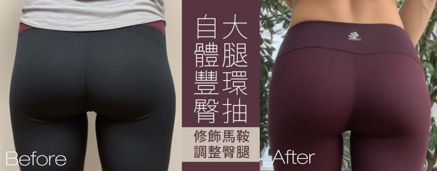 臀腰比