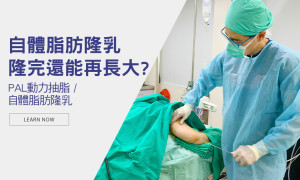 抽脂補胸怎麼抽？自體脂肪隆乳後還能越長越大？
