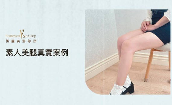 【真實案例分享】腿部抽脂大變身✨ 小短裙自由，重拾自信！