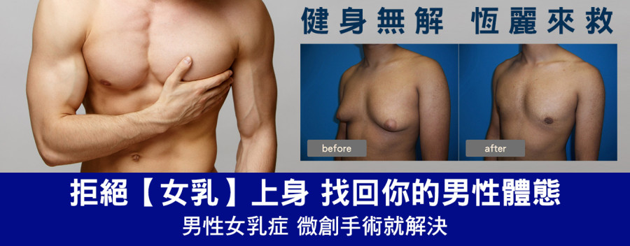 男性女乳症