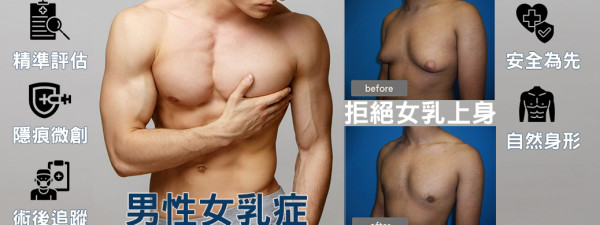 男性女乳症 微創手術就解決