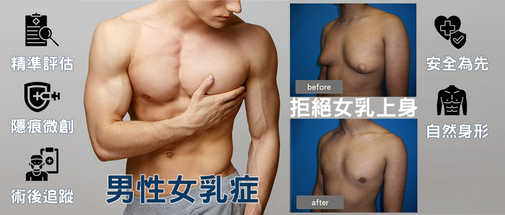 男性女乳症 微創手術就解決