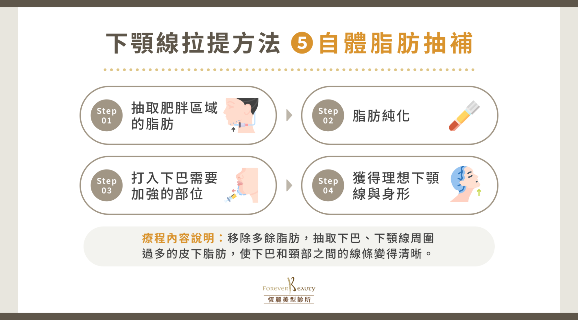 下顎線拉提方法 5:自體脂肪抽補